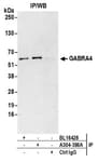 Detection of human GABRA4 by western blot of immunoprecipitates.