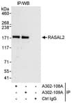 Detection of human RASAL2 by western blot of immunoprecipitates.