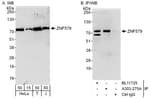 Detection of human ZNF579 by western blot and immunoprecipitation.