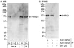 Detection of human and mouse PARG1 by western blot (h&amp;m) and immunoprecipitation (h).