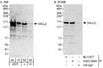 Detection of human SALL2 by western blot and immunoprecipitation.