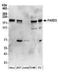 Detection of human and mouse PARD3 by western blot.