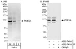 Detection of human PDE3A by western blot and immunoprecipitation.