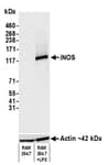 Detection of mouse iNOS by western blot.