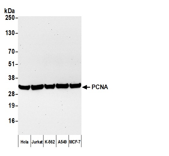 Goat anti-Mouse IgG2a Cross-Adsorbed Antibody Affinity PurifiedBethyl Laboratories