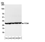 Detection of human PCNA by western blot with Affinity Purified Goat anti-Mouse IgG2a Cross-Adsorbed Antibody.