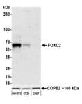 Detection of mouse FOXC2 by western blot.