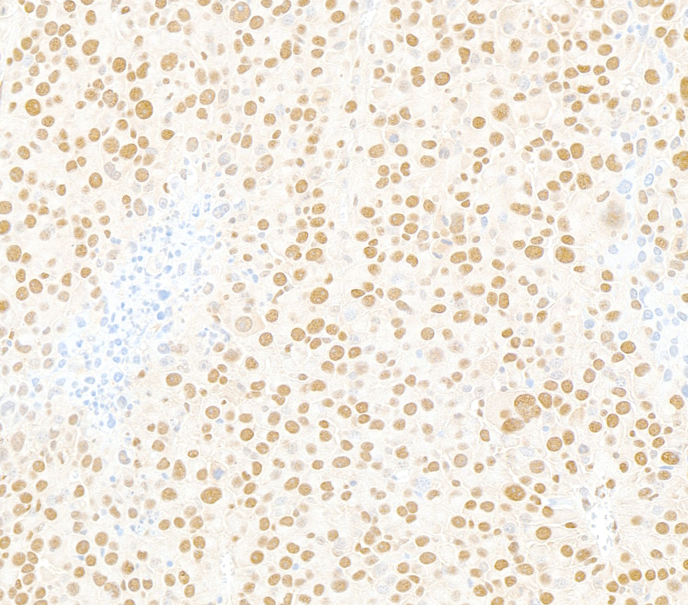 Detection of mouse XRN2 by immunohistochemistry.