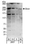 Detection of human Dicer by western blot.
