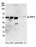 Detection of human NAP-2 by western blot.