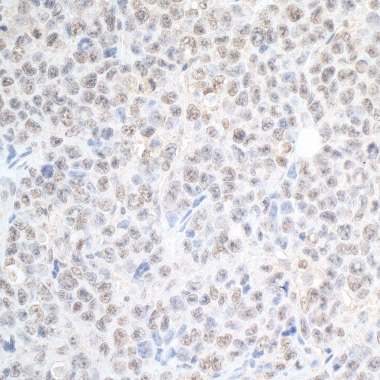Detection of mouse SPF45 by immunohistochemistry.