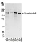 Detection of human Synaptojanin 2 by western blot.