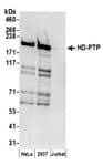 Detection of human HD-PTP by western blot.