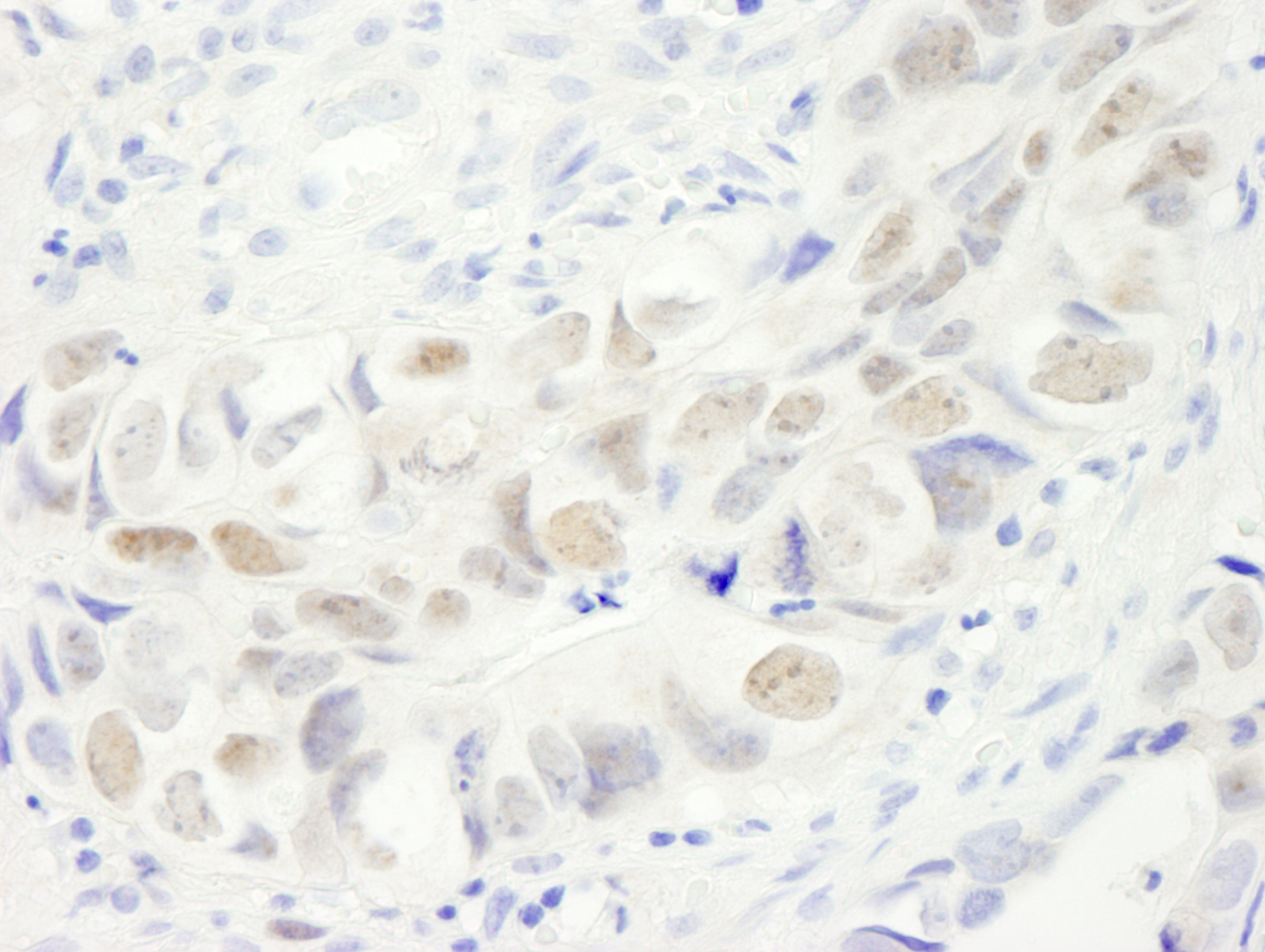 Rabbit anti-Anillin IHC Antibody