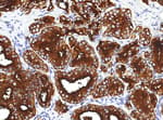 Detection of human PSMA by immunohistochemistry.