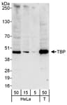 Detection of human TBP by western blot.