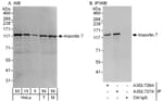 Detection of human and mouse Importin 7 by western blot (h&amp;m) and immunoprecipitation (h).