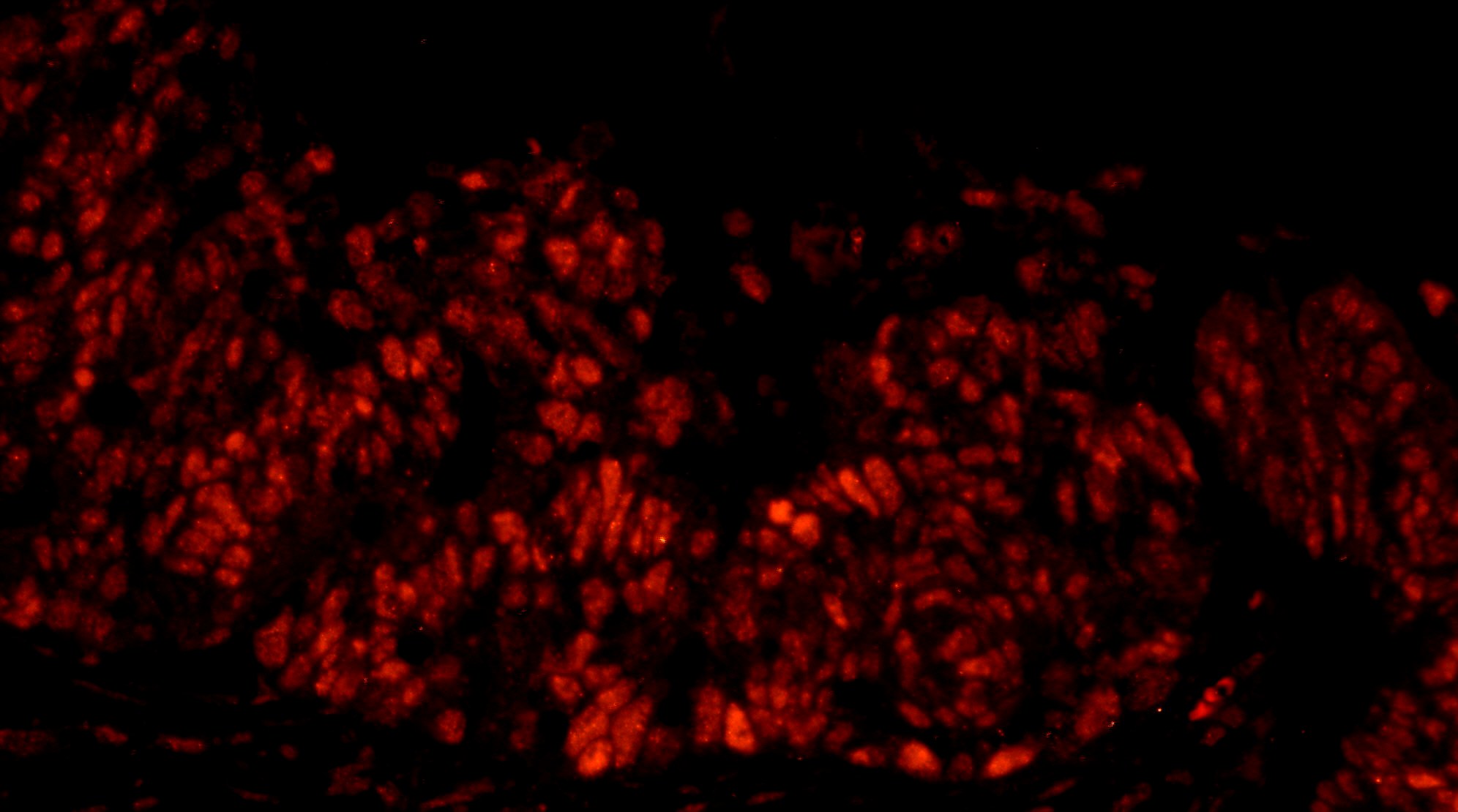 Rabbit anti-DFF45/DFFA IHC Antibody