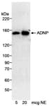 Detection of human ADNP by western blot.