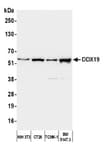 Detection of mouse DDX19 by western blot.