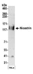 Detection of human Nicastrin by western blot.