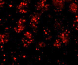 Rabbit anti-PHF6 IHC Antibody