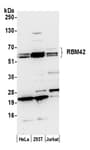 Detection of human RBM42 by western blot.