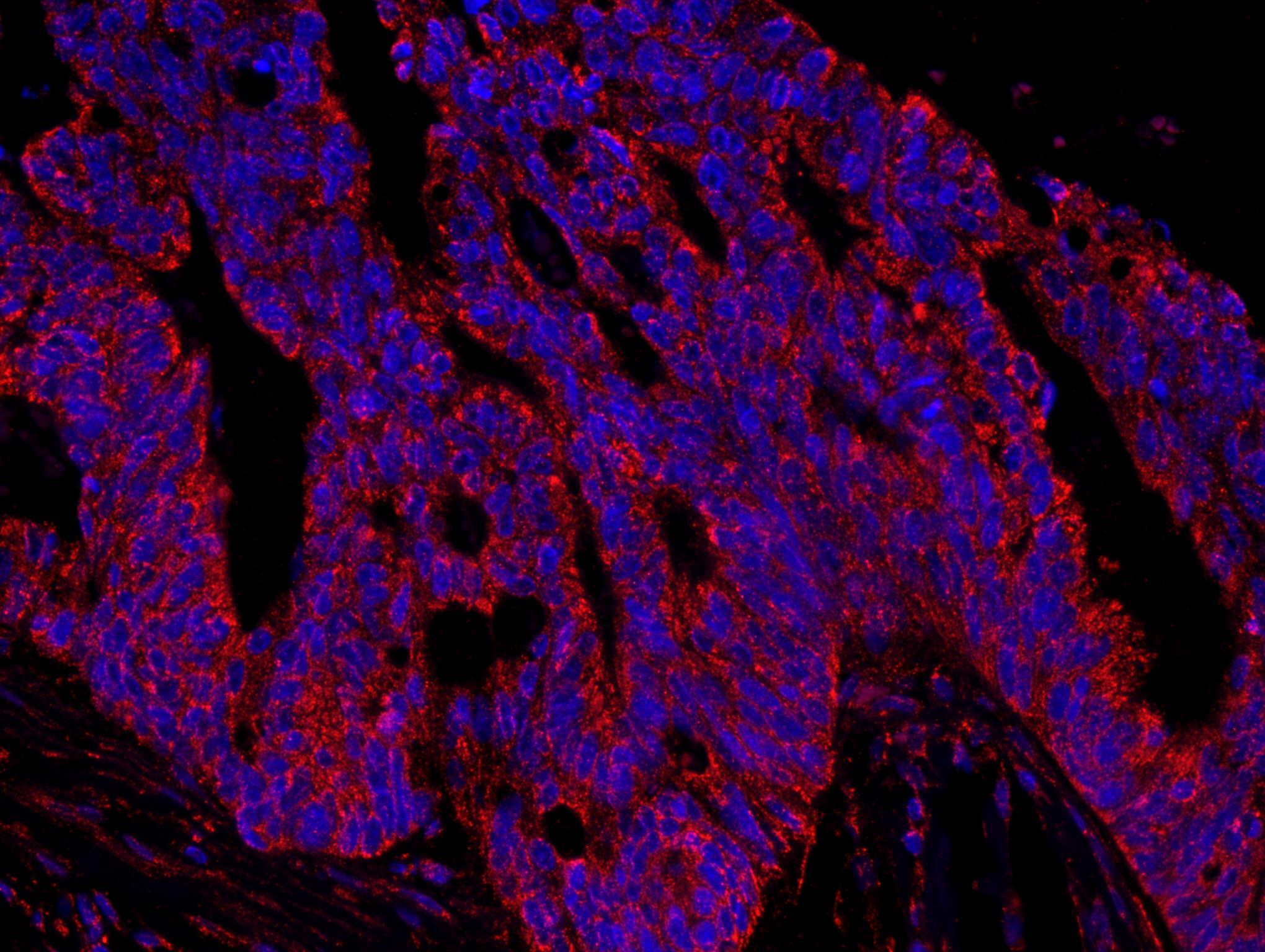 Rabbit anti-AKAP1 IHC Antibody