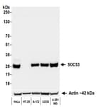 Detection of human SOCS3 by western blot.