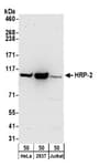 Detection of human HRP-2 by western blot.