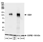 Detection of human CD21 by western blot.