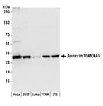 Detection of human and mouse Annexin V/ANXA5 by western blot.