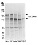 Detection of human and mouse RALGAPB by western blot.