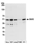Detection of human and mouse SNX5 by western blot.