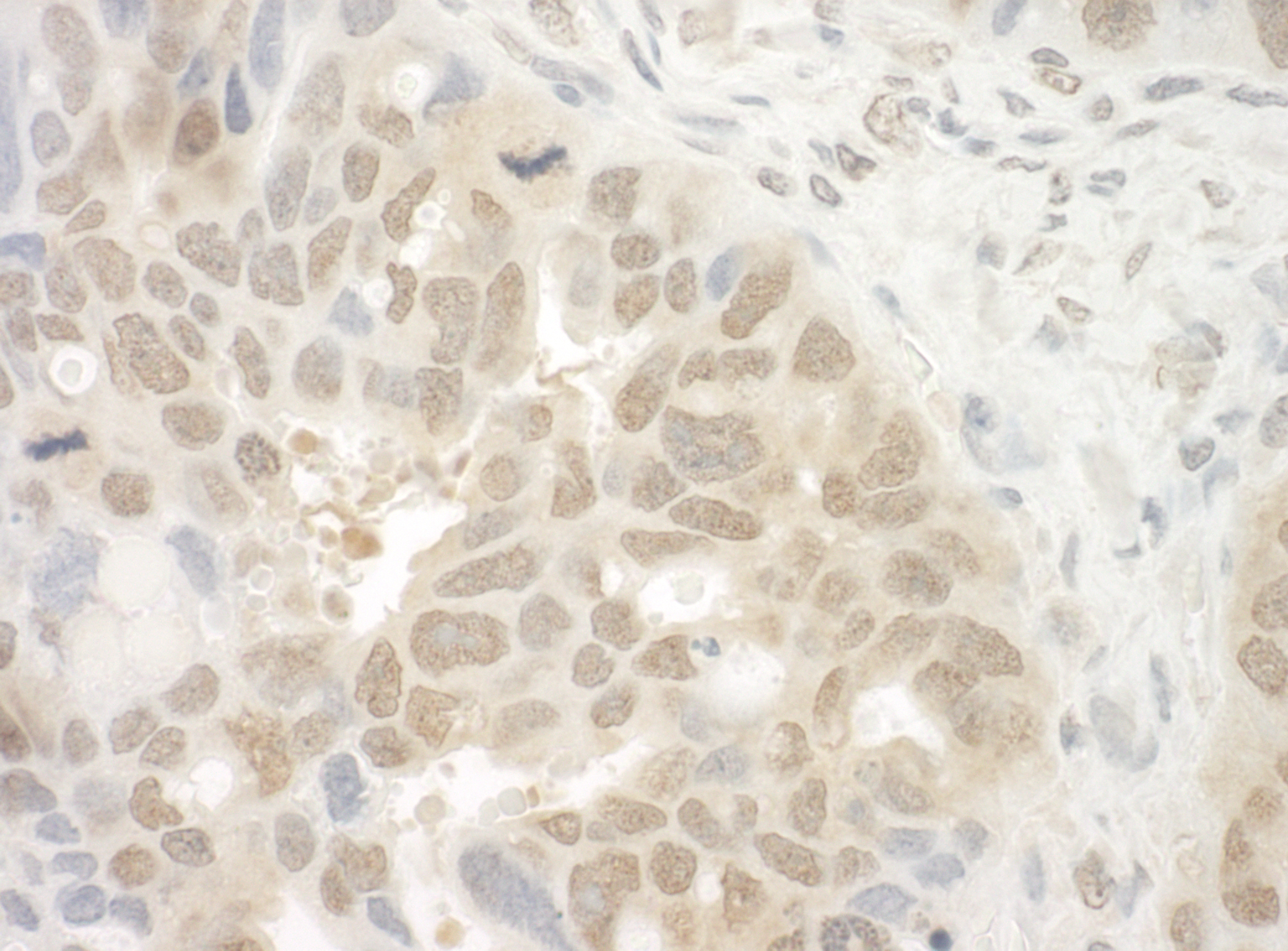 Rabbit anti-EYA4 IHC Antibody