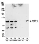 Detection of human and rat PRMT10 by western blot.
