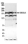 Detection of human CDC2L5 by western blot.