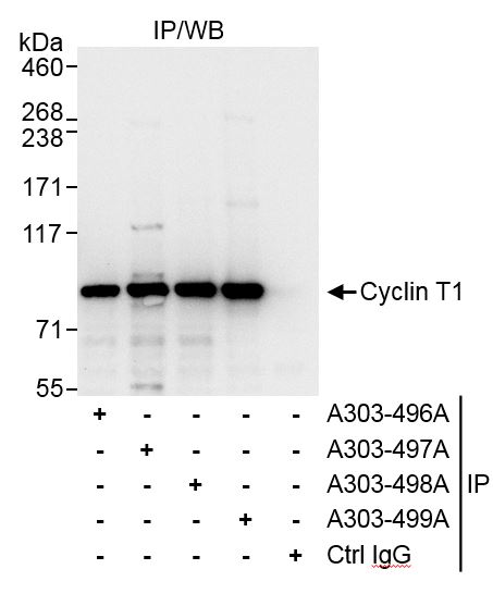 Detection of human Cyclin T1 by western blot of immunoprecipitates.