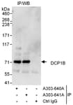 Detection of human DCP1B by western blot of immunoprecipitates.