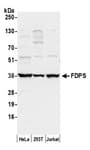 Detection of human FDPS by western blot.