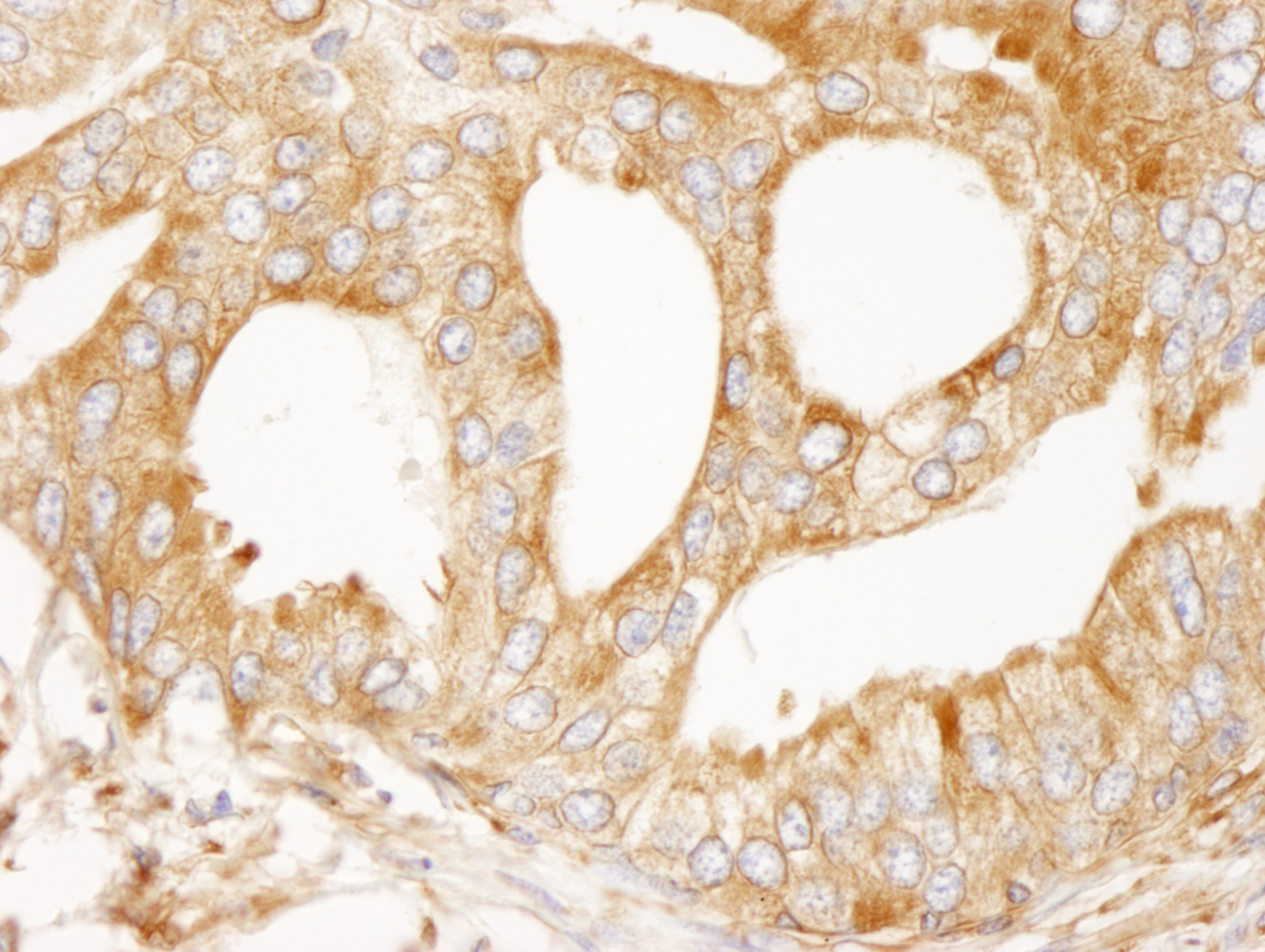 Rabbit anti-MAP4 IHC Antibody