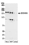 Detection of human ZCCHC6 by western blot.