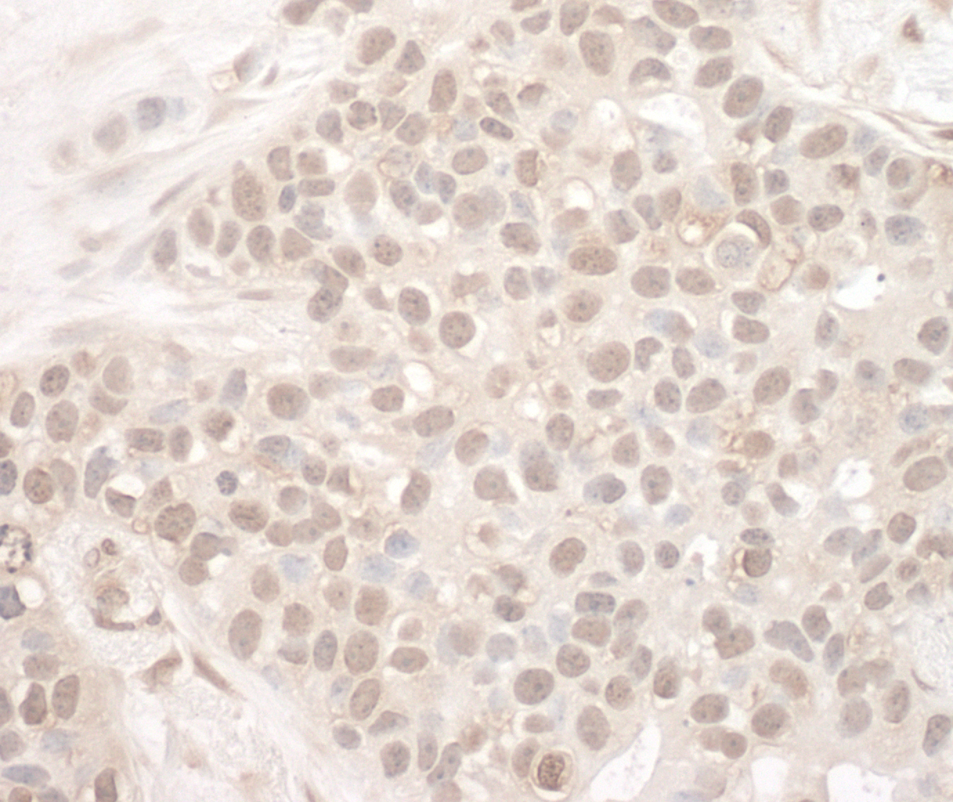 Rabbit anti-EYA2 IHC Antibody