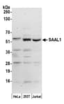 Detection of human SAAL1 by western blot.
