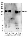 Detection of human and mouse LIFR by western blot.