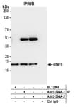 Detection of human RNF5 by western blot of immunoprecipitates.
