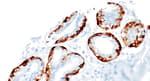 Detection of human Calponin-1 by immunohistochemistry.