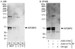Detection of human IGF2BP2 by western blot and immunoprecipitation.