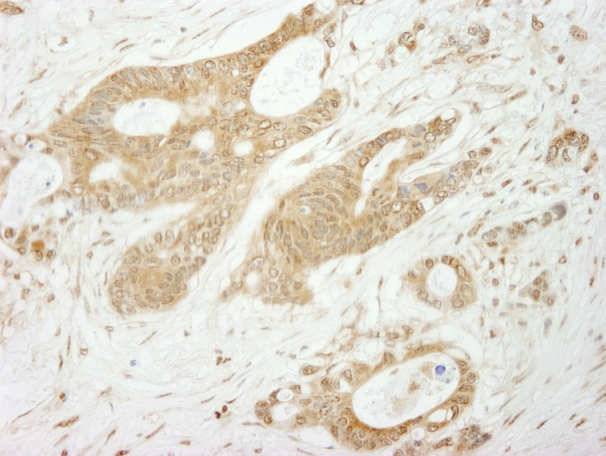 Rabbit anti-Notch1 IHC Antibody