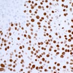 Detection of mouse 53BP1 by immunohistochemistry.